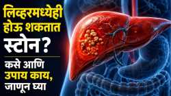 लिव्हरमध्येही होऊ शकतात स्टोन? चुकूनही ‘या’ ५ लक्षणांकडे करू नका दुर्लक्ष