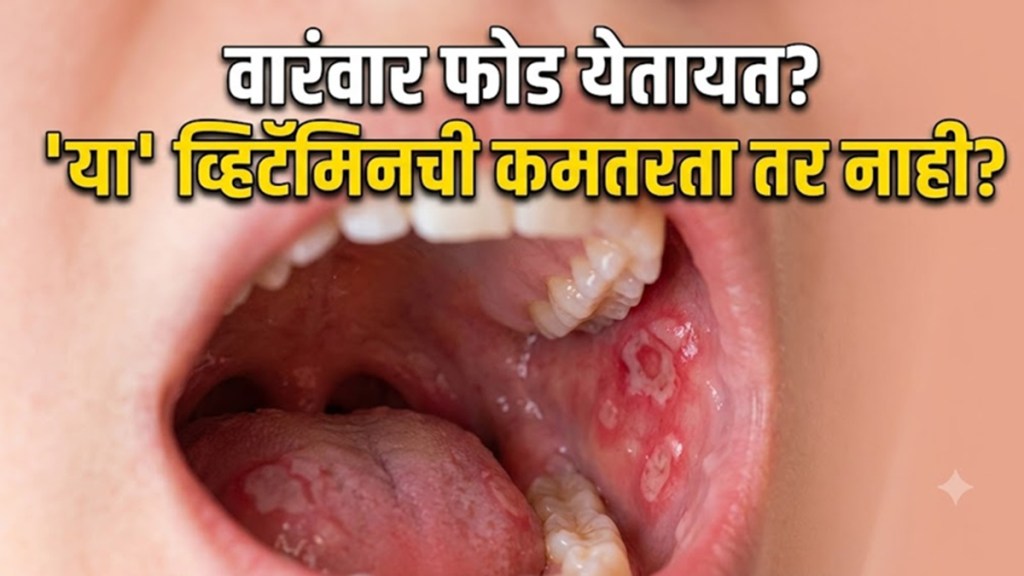Recurring mouth ulcers may indicate Vitamin B12 Folate Iron and Zinc deficiency Recurring mouth ulcers may indicate Vitamin B12 Folate Iron and Zinc deficiency