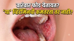 तोंडातील वारंवार फोड कोणत्या व्हिटॅमिनच्या कमतरतेमुळे येतात? डॉक्टरांनी सांगितलं खरं कारण आणि बचावाचे उपाय