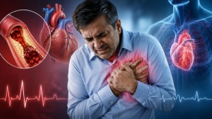 Heart Attack vs Heart Failure