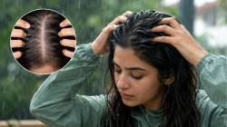 पावसाळ्यात केसगळती रोखण्यासाठी करा ‘या’ गोष्टी; तज्ज्ञांनी दिला टाळूच्या आरोग्यासाठी महत्त्वाचा सल्ला