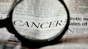 Nagpur AIIMS cancer surgery | complex medical operation Nagpur | ten kg tumor removal surgery Maharashtra | advanced HIPEC treatment AIIMS | rare Pseudomyxoma Peritonei surgery
