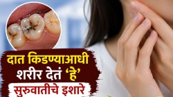 दातांवर कीड करतेय कब्जा हे कसं ओळखणार? ‘या’ ५ चिन्हांवरून लगेच ओळखा अन् करा ३ घरगुती उपाय, दात सडणार नाहीत!