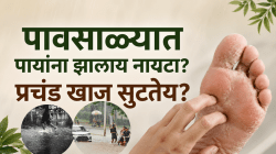 पावसाळ्यात पायांना सुटतेय खाज! नायट्याने त्रस्त आहात? डॉक्टरांचे ‘हे’ ७ रामबाण आयुर्वेदिक उपाय देतील झटपट आराम