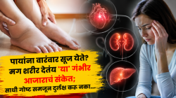 पायांना वारंवार सूज येते? मग शरीर देतंय ‘या’ गंभीर आजाराचं संकेत; साधी गोष्ट समजून दुर्लक्ष करू नका…
