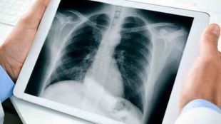 cooper-hospital-mumbai-xray-machines-out-of-order-patient-issues