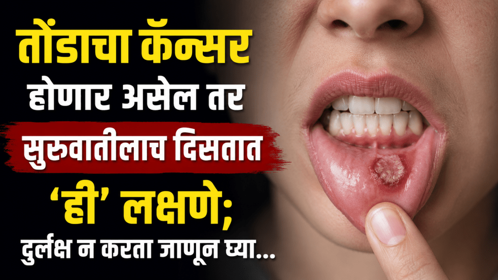 Oral Cancer Symptoms outh cancer early symptoms Oral Cancer Symptoms outh cancer early symptoms