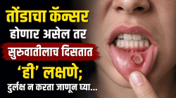 तोंडाचा कॅन्सर होणार असेल तर सुरुवातीलाच दिसतात ‘ही’ लक्षणे; तोंड येतं म्हणत दुर्लक्ष करणंही पडू शकतं महागात
