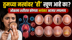 सावधान! नख पाहून ओळखा शरीरात कोणता भयंकर आजार लपलाय