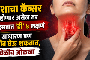 Throat Cancer Symptoms