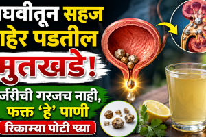 Ayurvedic remedies for Kidney Stone
