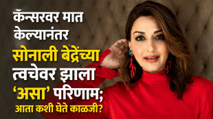 Sonali Bendre reveals skin routine after cancer