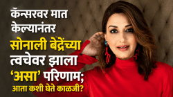 कॅन्सरवर मात केल्यानंतर सोनाली बेंद्रेच्या त्वचेवर झाला ‘असा’ परिणाम; आता कशी घेते काळजी? स्वत:च सांगितलं स्किन केअर रूटीन