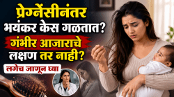 Postpartum hair loss: प्रेग्नेंसीनंतर भयंकर केस गळतात? गंभीर आजाराचे लक्षण तर नाही? लगेच जाणून घ्या फरक
