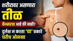 शरीरावर असणारा तीळ कॅन्सरचा आहे की नाही?; दुर्लक्ष न करता ‘या’ प्रकारे घरीच ओळखा, अन्यथा ब्रेस्ट कॅन्सरचा धोका