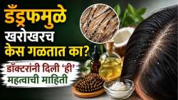 डँड्रफमुळे खरोखरच केस गळतात का? त्यावर उपचार काय? डॉक्टरांनी दिली ‘ही’ महत्वाची माहिती