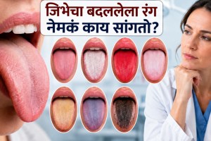 Tongue Color Health Signs