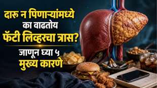 Non Alcoholic Fatty Liver Disease