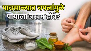 Shoe Bite Remedy Natural Treatment & Home Remedies