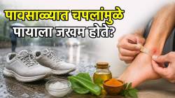पावसाळ्यात नव्या-कोऱ्या चपलांमुळे शु बाईट होते? मग ‘हे’ ५ उपाय नक्की करा, पायाची जखम लवकर होईल बरी