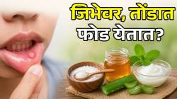 कधी जिभेवर तर कधी तोंडात; सतत तोंड येत असेल तर करा ‘असे’ घरगुती उपाय; डॉक्टरांनी सांगितले फायदे