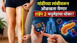 मांडीच्या लांबीवरून ओळखता येणार टाईप २ मधुमेहाचा धोका? डॅनिश संशोधकांचा धक्कादायक खुलासा