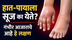 हात-पायाला वारंवार सूज येतेय? दुखत नसलं तरी दुर्लक्ष करू नका; ‘या’ आजाराचं असू शकतं लक्षण