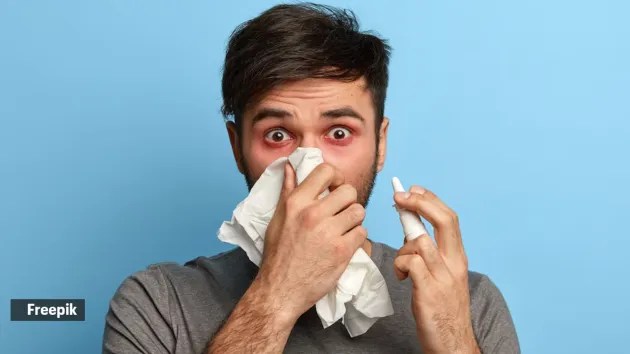 remedies for morning face swelling