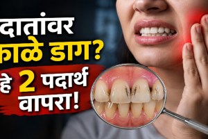 Garlic and cloves as common kitchen ingredients for temporary toothache relief and oral health