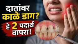 दातांतील कीड पडेल ५ मिनिटांत बाहेर; फक्त चावून खा स्वयंपाकघरातील ‘हे’ २ पदार्थ; पिवळे-काळे दात होतील मोत्यांसारखे चमकदार!