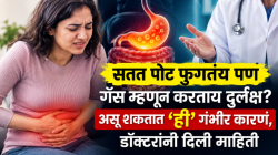 सतत पोट फुगतंय पण गॅस म्हणून करताय दुर्लक्ष? असू शकतात ‘ही’ गंभीर कारणं, डॉक्टरांनी दिली माहिती