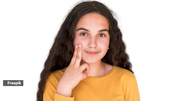 remedies for morning face swelling