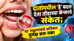 Oral Cancer: दातांमधील ‘हे’ बदल देतात तोंडाच्या कॅन्सरचे संकेत; ‘या’ लक्षणांकडे अजिबात दुर्लक्ष करू नका
