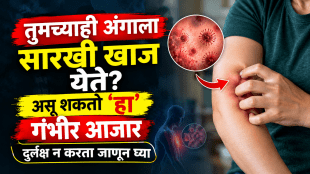 Liver Disease Pruritus Symptoms