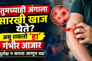 Liver Disease Pruritus Symptoms