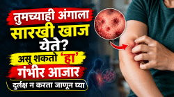 तुमच्याही अंगाला सारखी खाज येते? असू शकतो ‘हा’ गंभीर आजार; दुर्लक्ष न करता जाणून घ्या