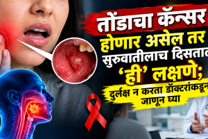 Chronic tongue pain and difficulty opening your mouth do not ignore these signs
