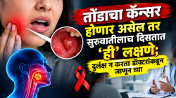 तोंडाचा कॅन्सर होणार असेल तर सुरुवातीलाच दिसतात ‘ही’ लक्षणे; दुर्लक्ष न करता डॉक्टरांनी सांगितलेली कारणं, उपचार-उपाय जाणून घ्या
