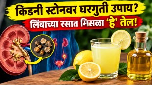 Kidney stone pain with natural remedies including lemon juice dandelion and hibiscus