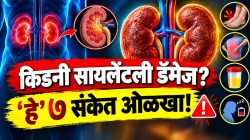 सुरुवातीला कळतच नाही! किडनीवर सूज आल्यावर शरीर देतं ‘हे’ ७ संकेत; किडनी सायलेंटली डॅमेज होण्याआधी वेळीच ओळखा, नाहीतर…