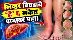 लिव्हर सडण्यापूर्वी पाय देतात ‘हे’ ६ भयंकर संकेत! वेळेत ओळखा लक्षणे; ‘पायाखालची जमीन निसटण्यापूर्वी’ सावध व्हा!