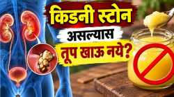 किडनी स्टोन असणाऱ्यांनी तूप सोडायचं? जाणून घ्या खरं काय!