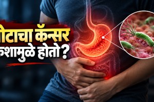 Stomach Cancer Causes