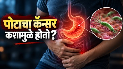 पोटाचा कर्करोग नेमका कशामुळे होतो? संशोधन काय सांगते?