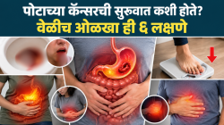 जळजळ, गॅस, अपचन…. साधा त्रास समजू नका, पोटाच्या कॅन्सरची सुरुवात कशी होते? वेळीच ओळखा ही ६ लक्षणे, ऑन्कोलॉजिस्टचा सल्ला
