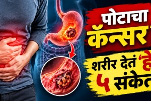 Stomach cancer symptoms showing five early warning signs including acidity, indigestion, bloating, nausea, and unexplained weight loss