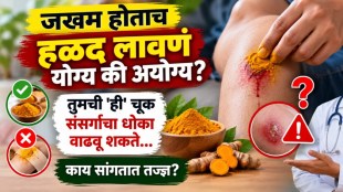 applying turmeric on open wound risk | first aid for cuts and injuries marathi health tips | skin infection prevention turmeric paste on wound | home remedies for wound healing safety