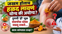 जखम होताच हळद लावणं योग्य की अयोग्य? तुमची ‘ही’ चूक संसर्गाचा धोका वाढवू शकते… काय सांगतात तज्ज्ञ?