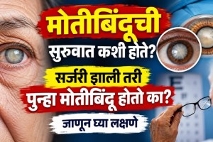cataract eye symptoms | motibindu lakshane marathi | cataract surgery procedure | eye care tips marathi