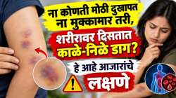 ना कोणती मोठी दुखापत ना मुक्कामार तरी, शरीरावर दिसतात काळे-निळे डाग? हे आहे आजारांचे लक्षणे
